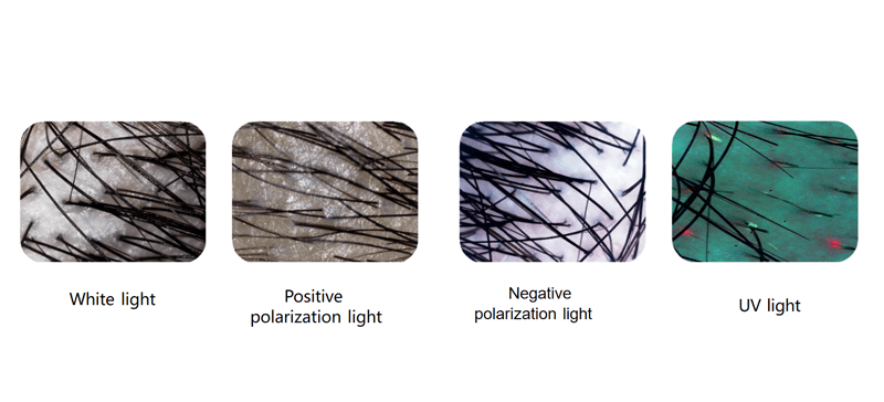 hair analyzer AI