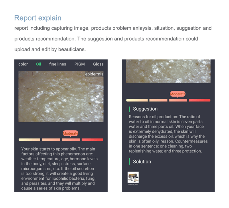 portable skin analysis
