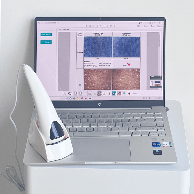 skin analyzer machine