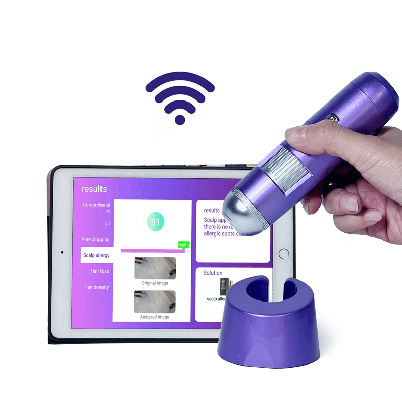 scalp analyzer for API connection
